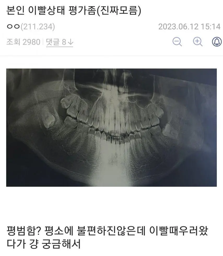 욕 나오는 사랑니 모음집